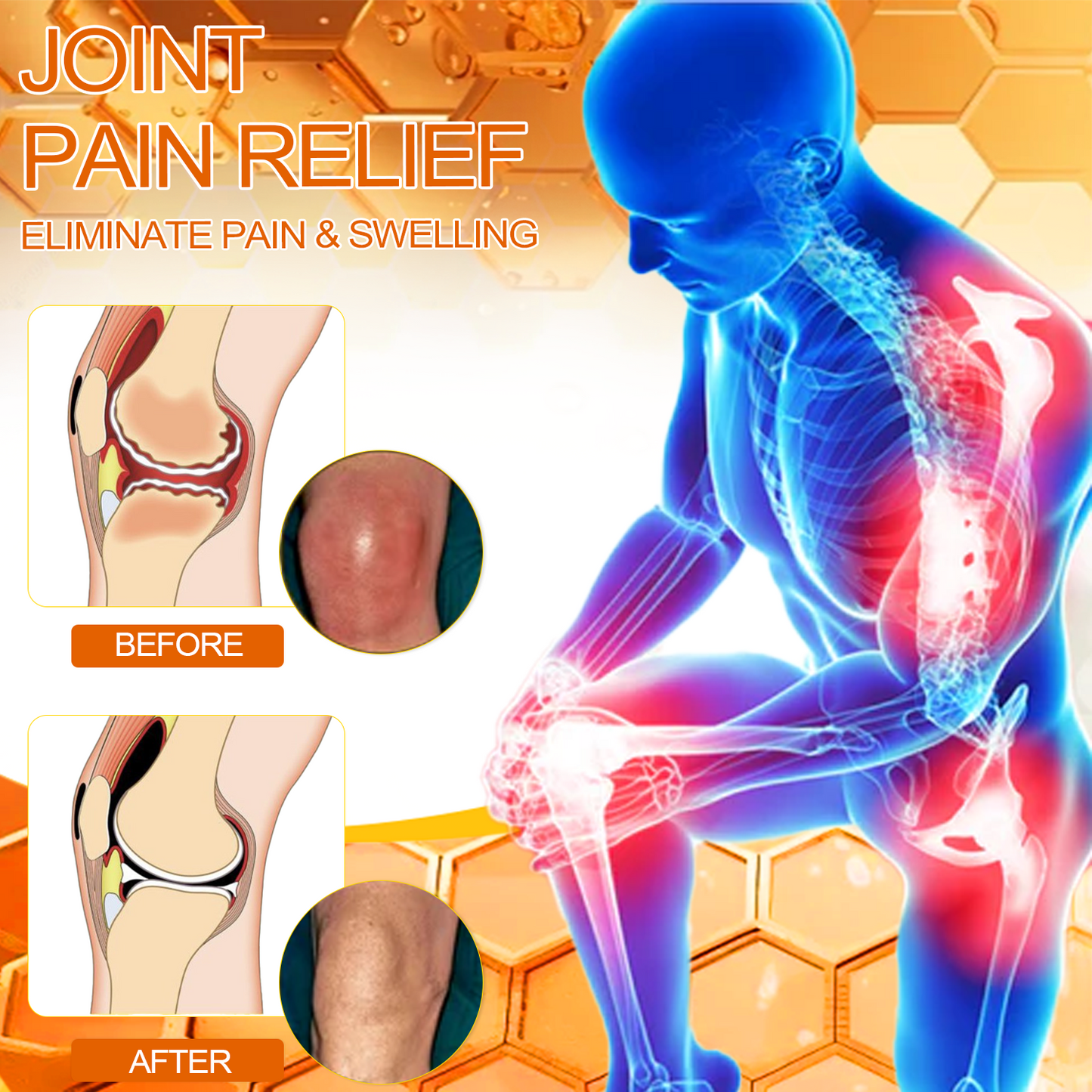 Lovilds™ Bee Poison Arthritis Therapy Cream(Specially for older adults & AAOS recommends)