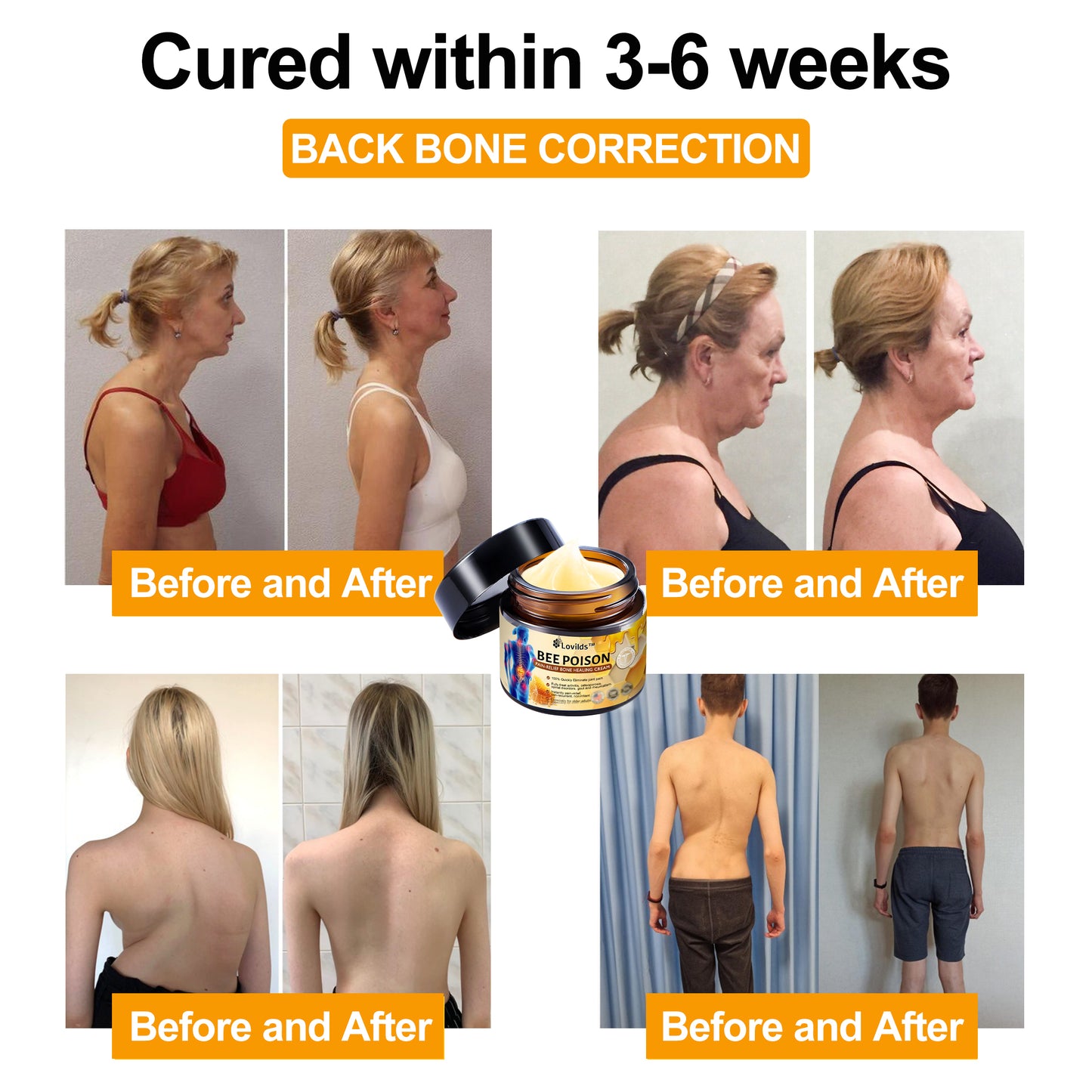 Lovilds™ Bee Poison Arthritis Therapy Cream(Specially for older adults & AAOS recommends)