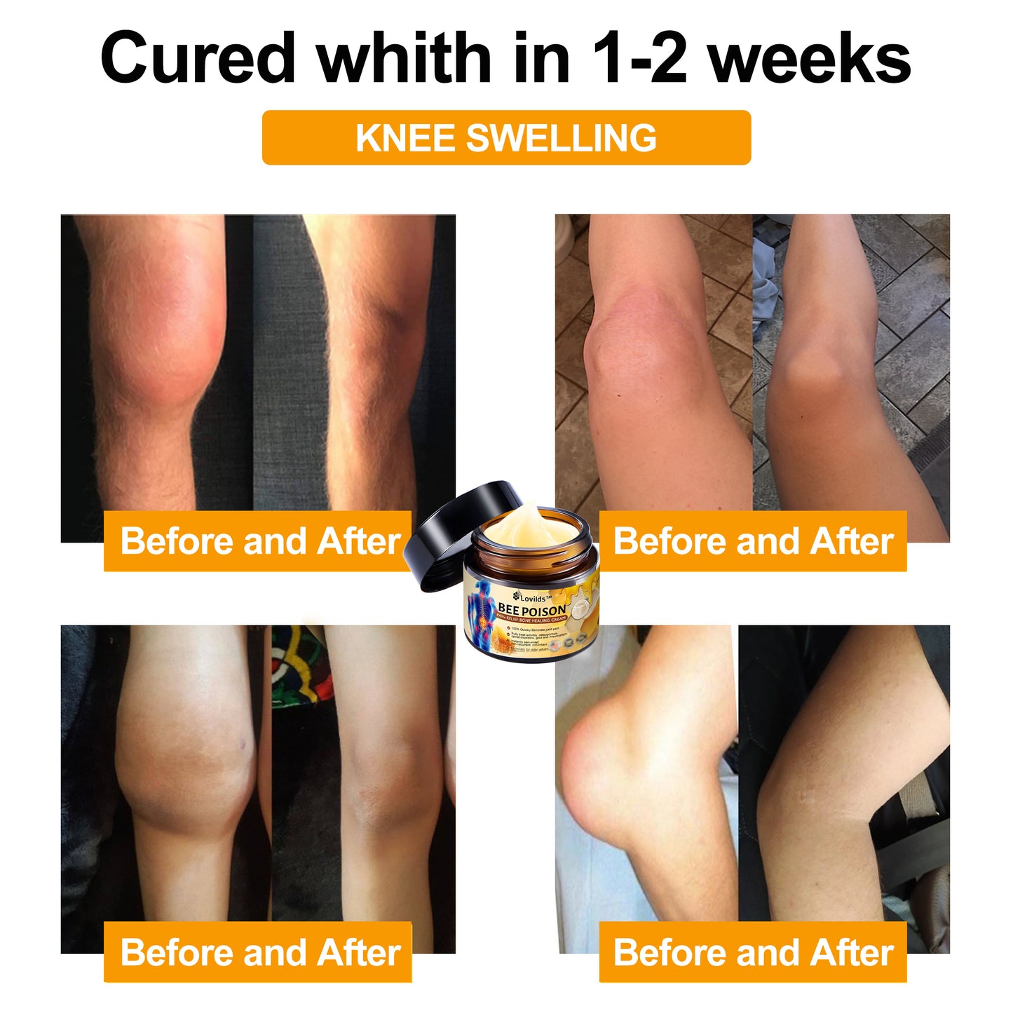 Lovilds™ Bee Poison Arthritis Therapy Cream(Specially for older adults & AAOS recommends)