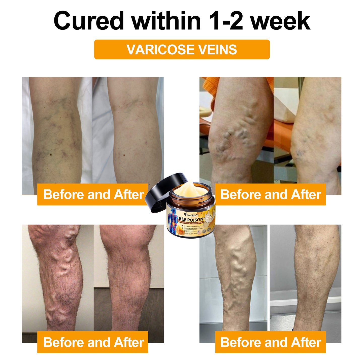 Lovilds™ Bee Poison Arthritis Therapy Cream(Specially for older adults & AAOS recommends)
