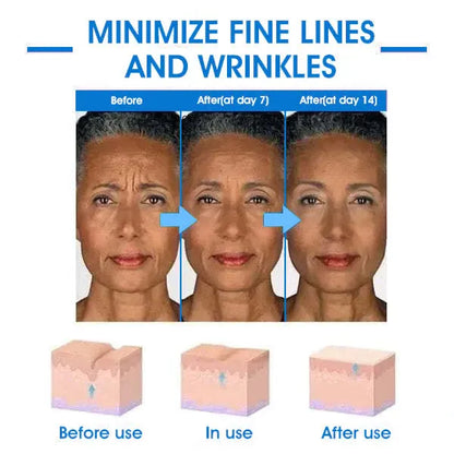 LOVILDS™ Ultra Firming & Revitalizing Cream (Renew Skin Firmness)