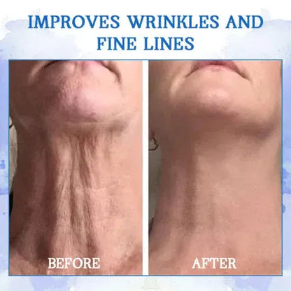 LOVILDS™ Ultra Firming & Revitalizing Cream (Renew Skin Firmness)