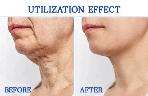 LOVILDS™ Ultra Firming & Revitalizing Cream (Renew Skin Firmness)